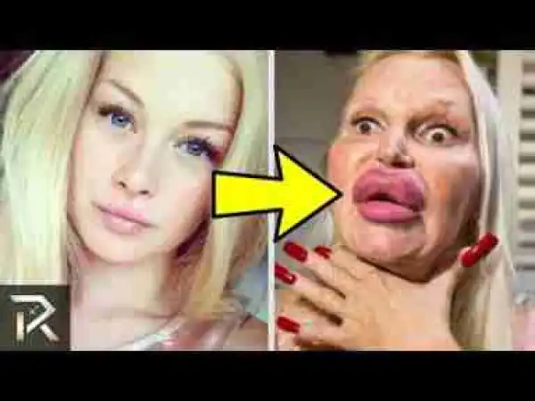 Video: RICH People Who Turned Themselves Into PLASTIC
